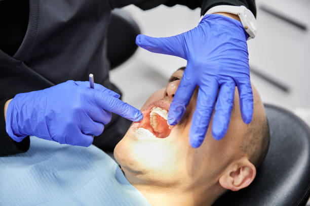 Best Emergency Wisdom Tooth Extraction in Oostburg, WI
